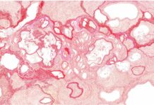 Das österreichische ROMANES – Ausstellung zum Volksgruppentag / Parlament, Wien